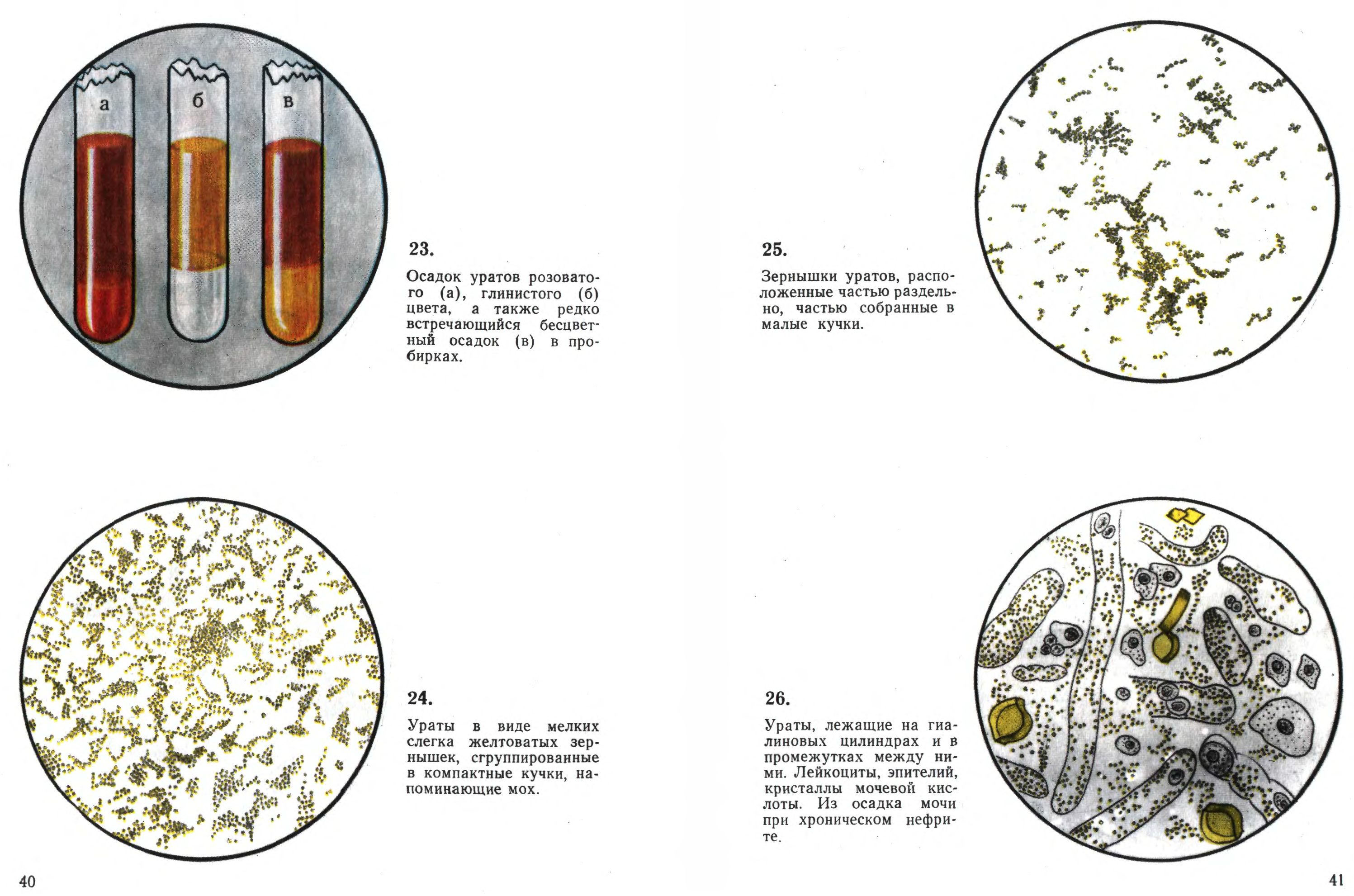 Ураты в моче у взрослого. Краевский атлас микроскопии осадков мочи. Микроскопии осадков мочи Краевский в.я. Микроскопия осадка мочи атлас. Краевский атлас микроскопии осадков мочи книга.