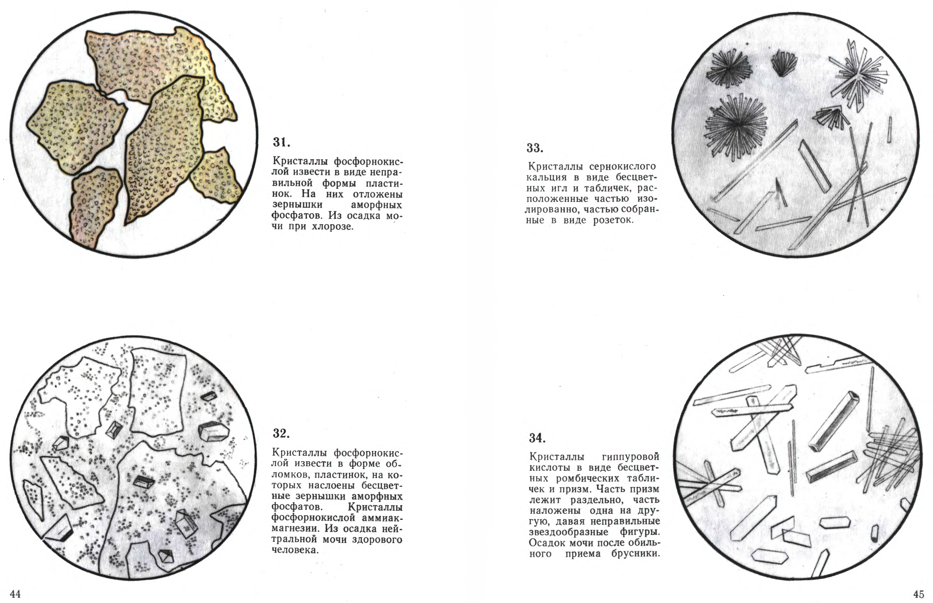 Анализ микроскопия. Микроскопия мочи осадка мочи атлас. Микроскопия мочи атлас. Микроскопии осадков мочи Краевский в.я. Атлас микроскопии осадков мочи Краевский в.я.