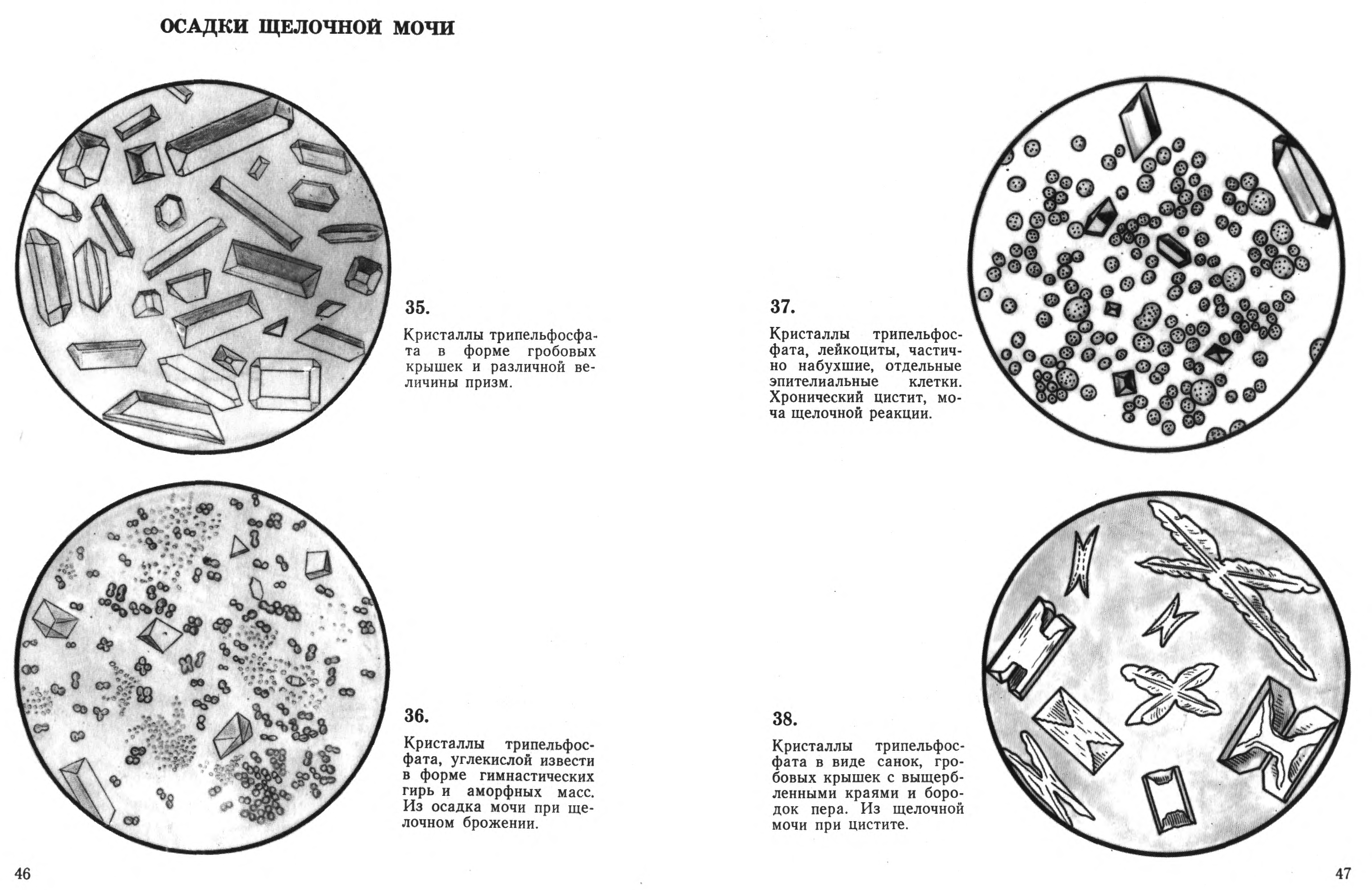 Осадки мочи под микроскопом в картинках крупным планом