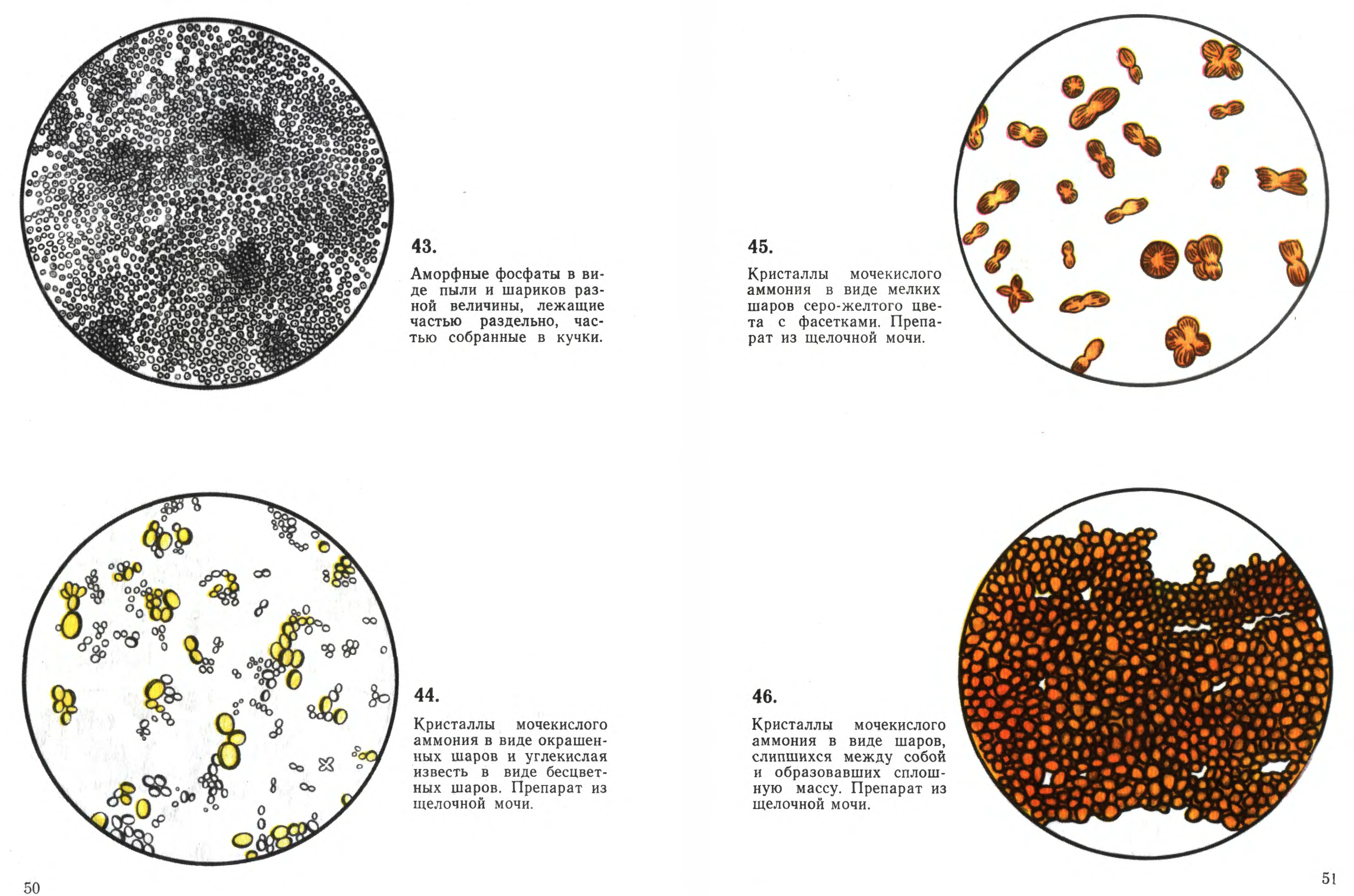 Микроскопия осадка. Микроскопия осадка мочи атлас. Микроскопия мочи атлас. Микроскопии осадков мочи Краевский в.я. Атлас по микроскопии мочи.