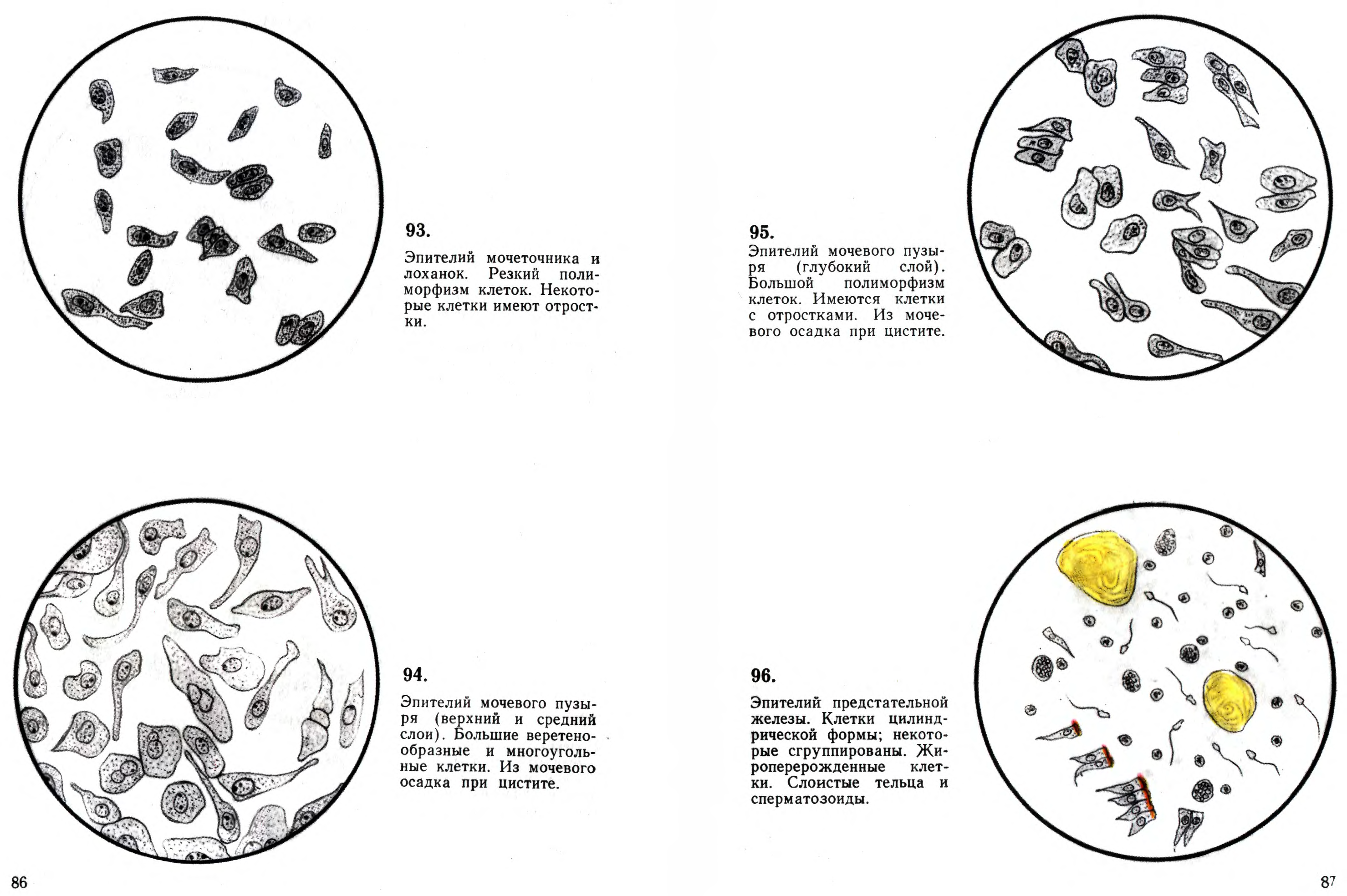 оам эпителий плоский норма. я. микроскопическое исследование мочи почечный эпителий. эпителий плоский в моче норма у ребенка 11 лет. нормы анализа мочи общий микроскопическое исследование.
