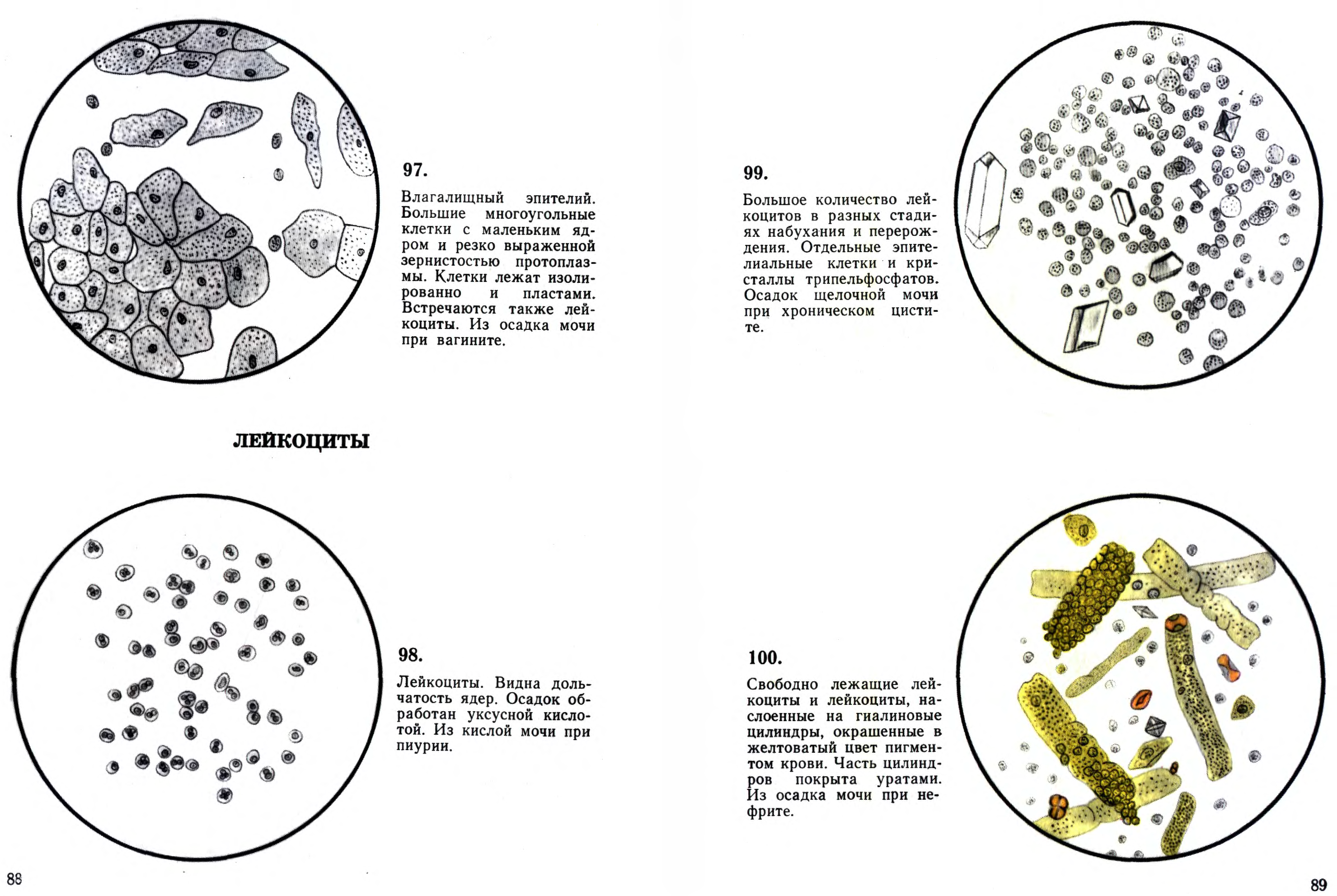 Осадок в моче. Микроскопии осадков мочи Краевский в.я. Микроскопия осадка мочи атлас. Микроскопия мочи атлас. Атлас микроскопии осадков мочи Краевский в.я.