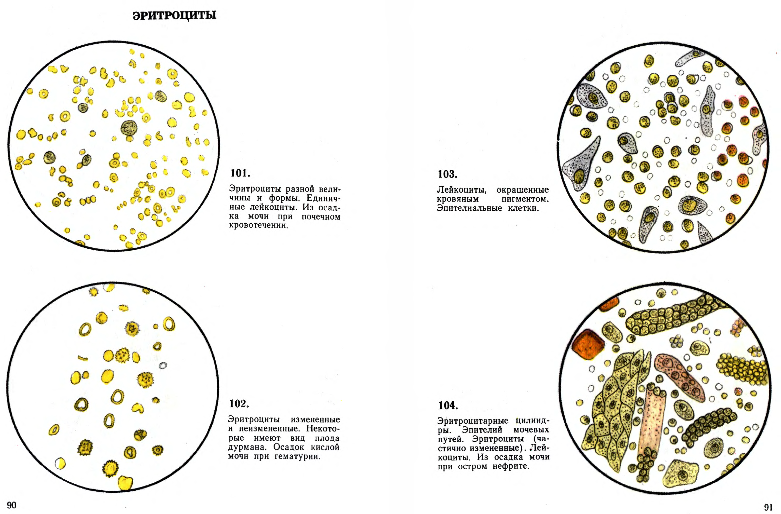 Лейкоциты в моче у собаки. Микроскопия осадка мочи атлас. Микроскопии осадков мочи Краевский в.я. Краевский атлас микроскопии осадков мочи книга. Атлас микроскопии осадков мочи Краевский в.я.