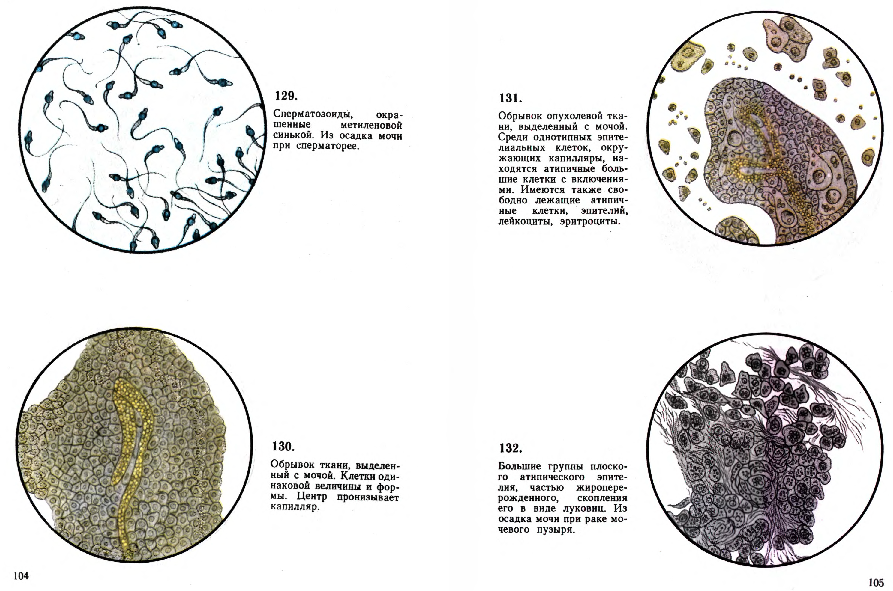 Осадки мочи микроскопия. Микроскопия осадка мочи атлас. Атлас микроскопии осадков мочи. Атлас микроскопии. Микроскопия осадка мочи фото с описанием.
