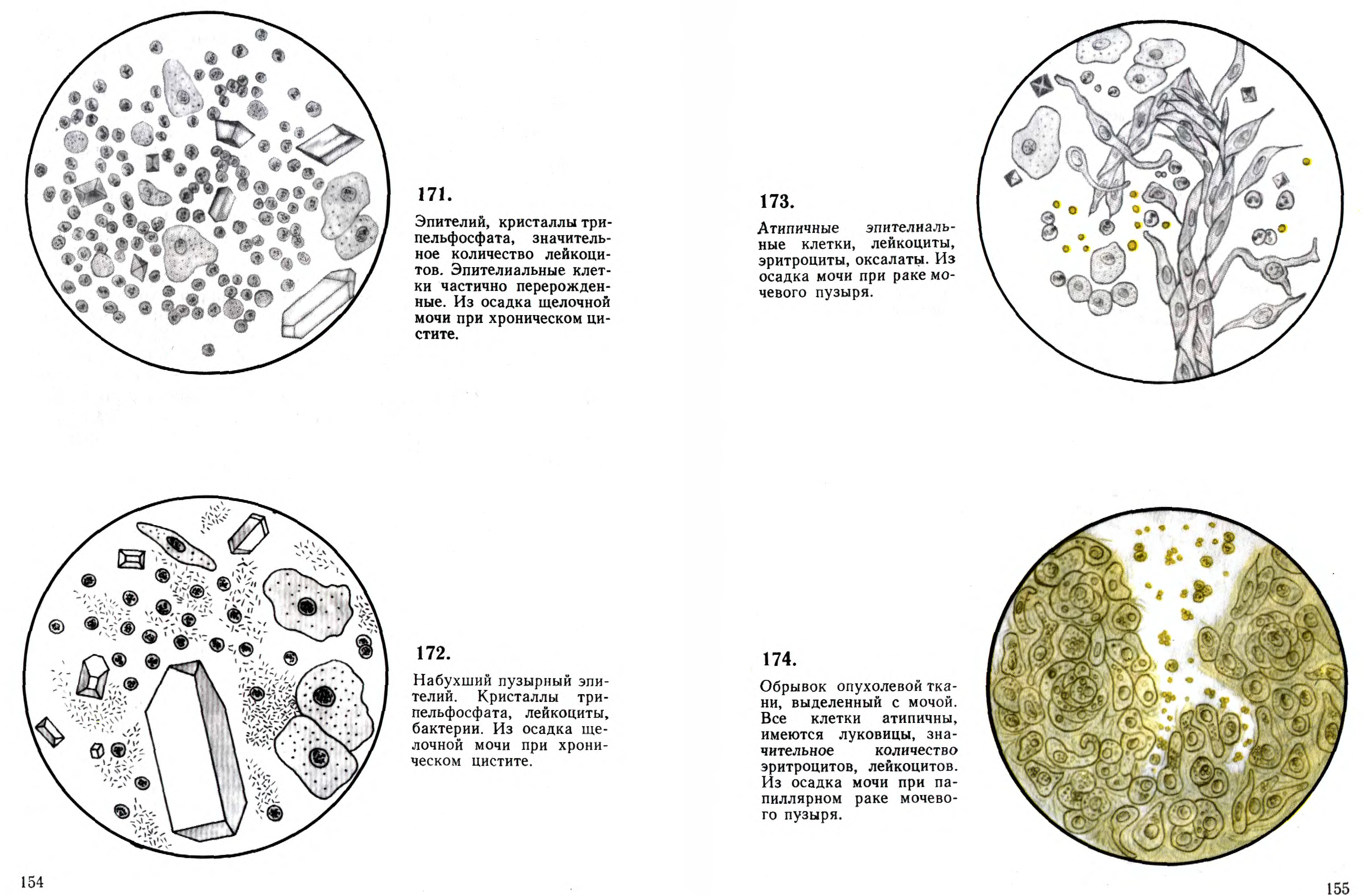 Осадки мочи. Микроскопии осадков мочи Краевский в.я. Микроскопия мочи осадка мочи атлас. Микроскопия осадка мочи атлас. Атлас микроскопии осадков мочи Краевский в.я.