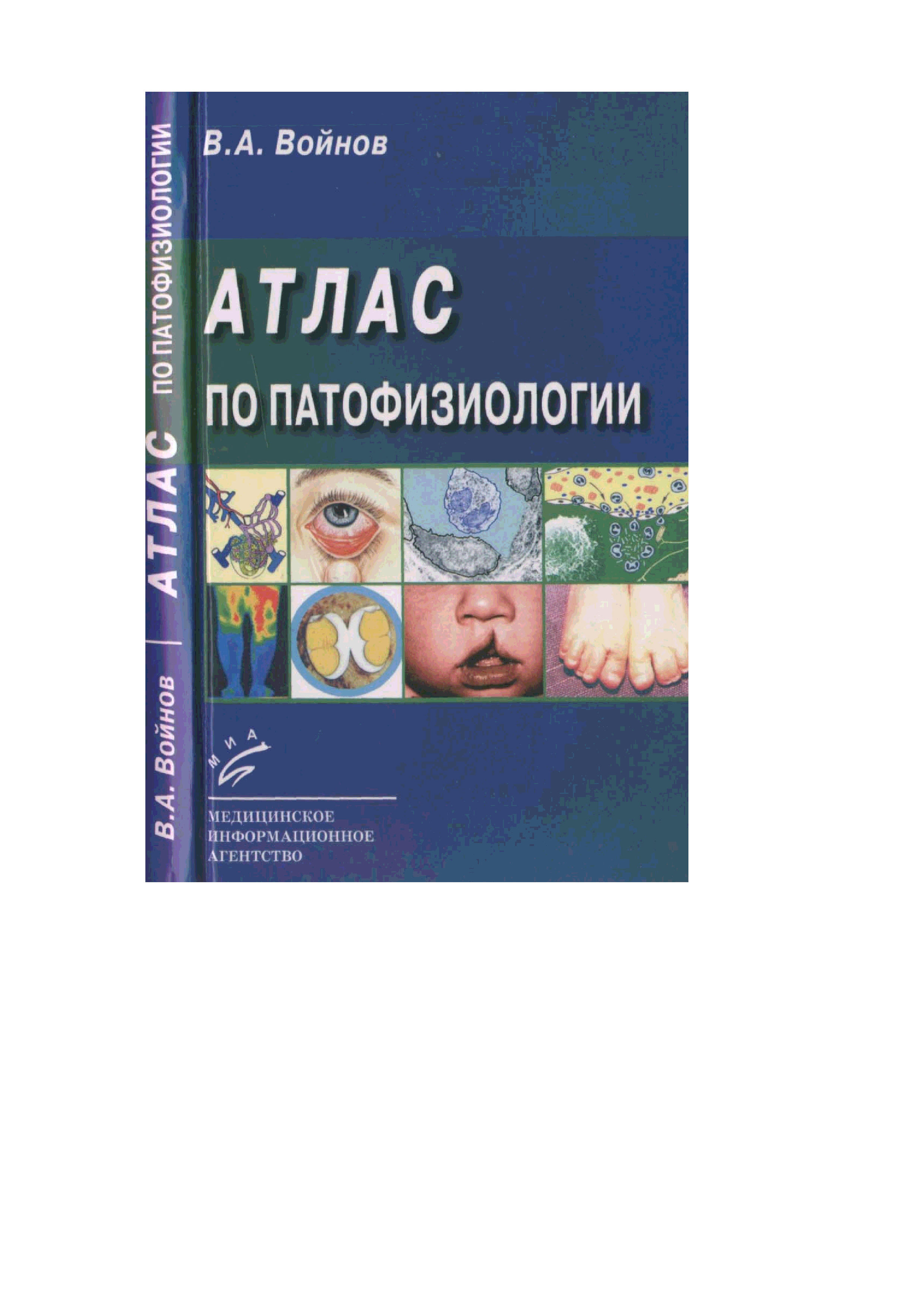 Литвицкий патофизиология. Патофизиология атлас. Атлас по патофизиологии Войнов.