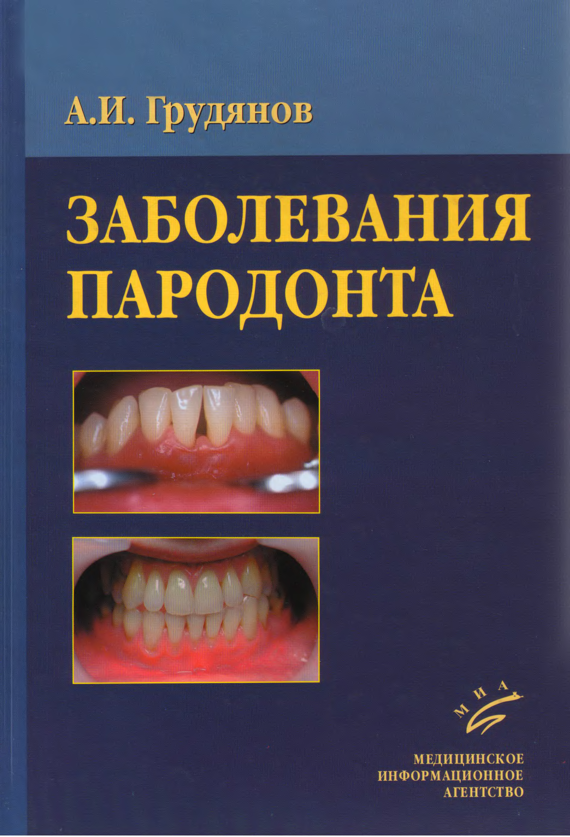 Заболевания книга. Грудянов заболевания пародонта. Пародонтит заболевания пародонта. Учебник по пародонтологии. Пародонтология книги.