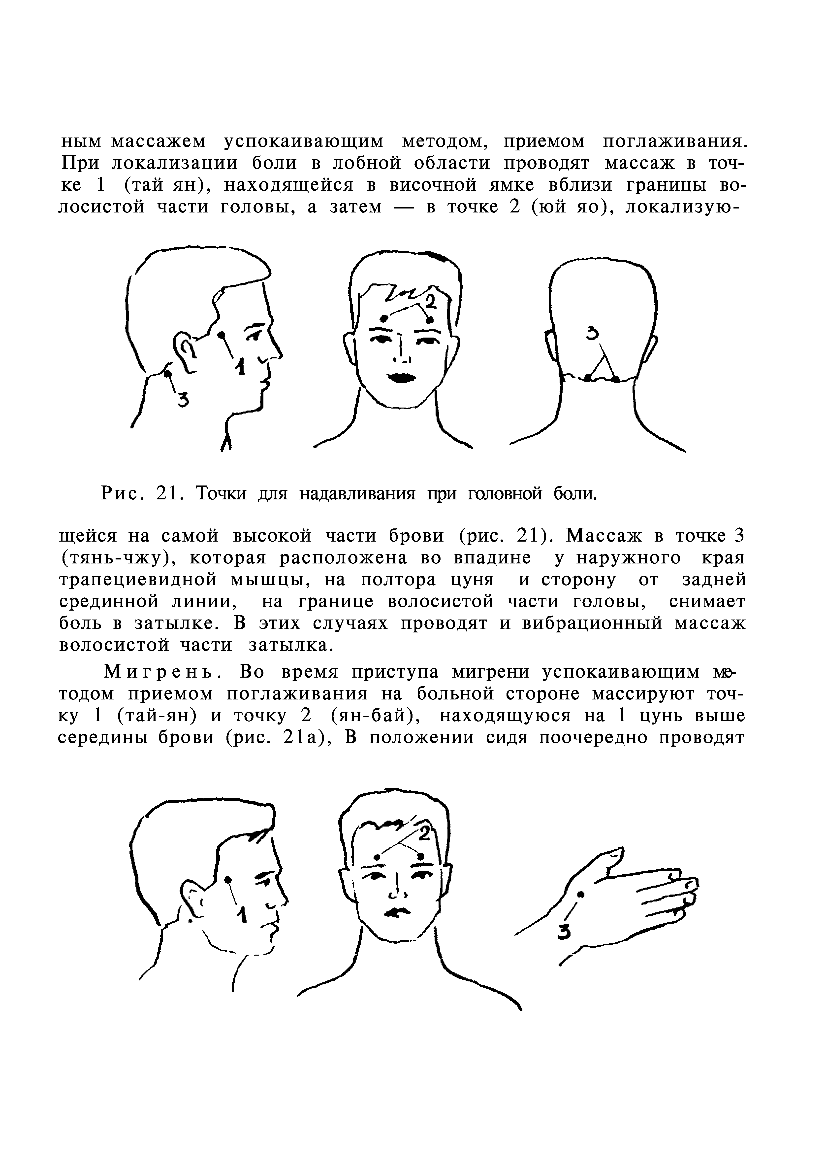 Какую точку массировать при головной. Точки при головной боли. Точечный массаж головы. Точки массажа от головной боли. Точечный массаж при головной боли.