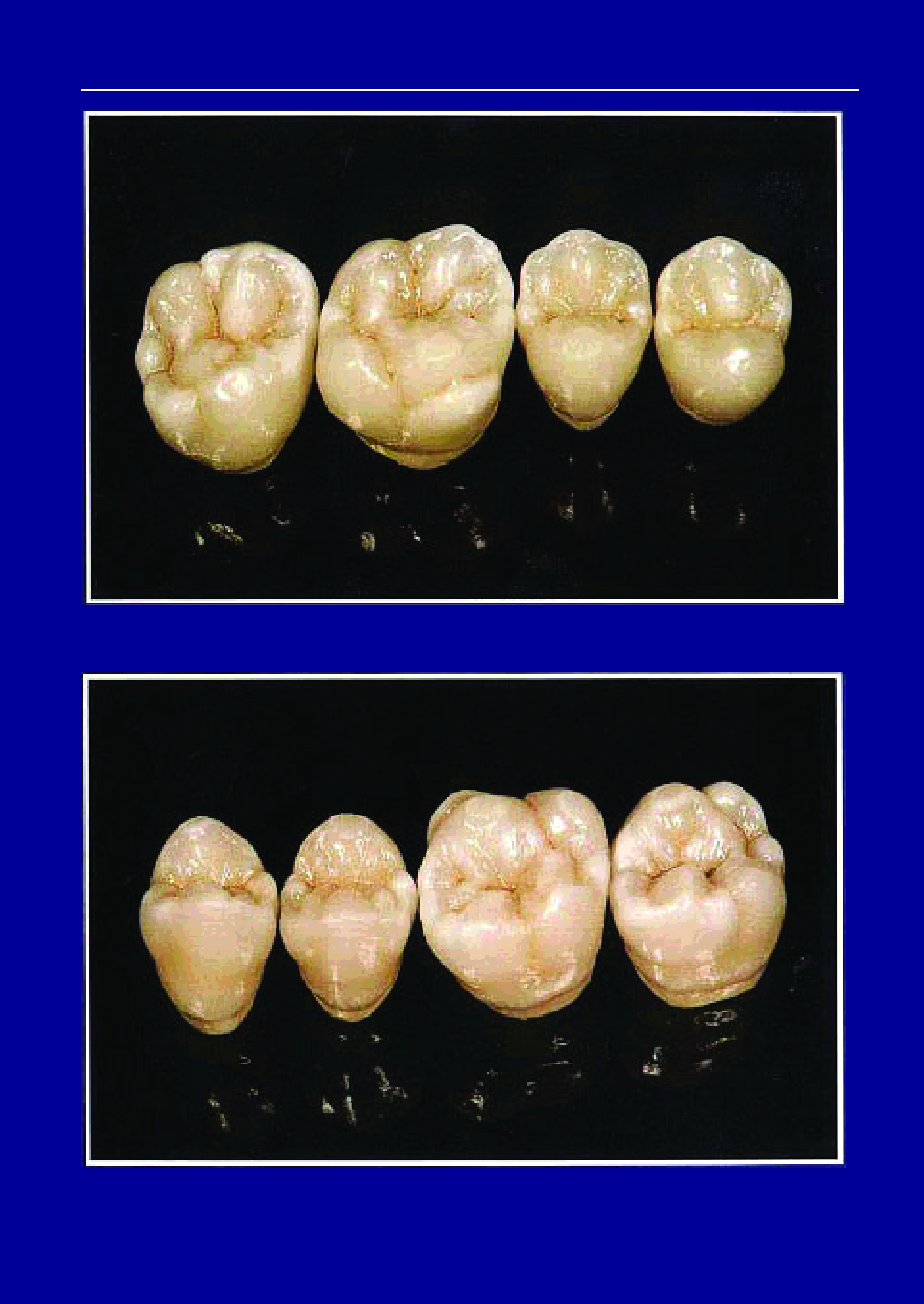 26 Зуб анатомия жевательной поверхности