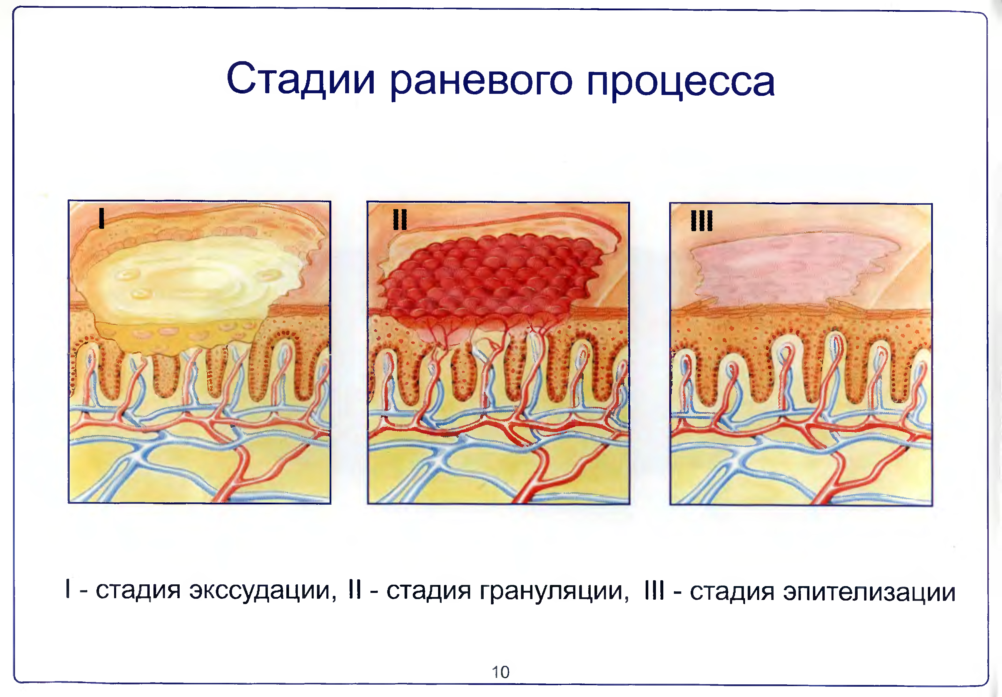 Пролиферация раны. Пролиферация раны. Стадии раны раневого процесса. Пролиферативная фаза заживления раны. Фазы и стадии раневого процесса.