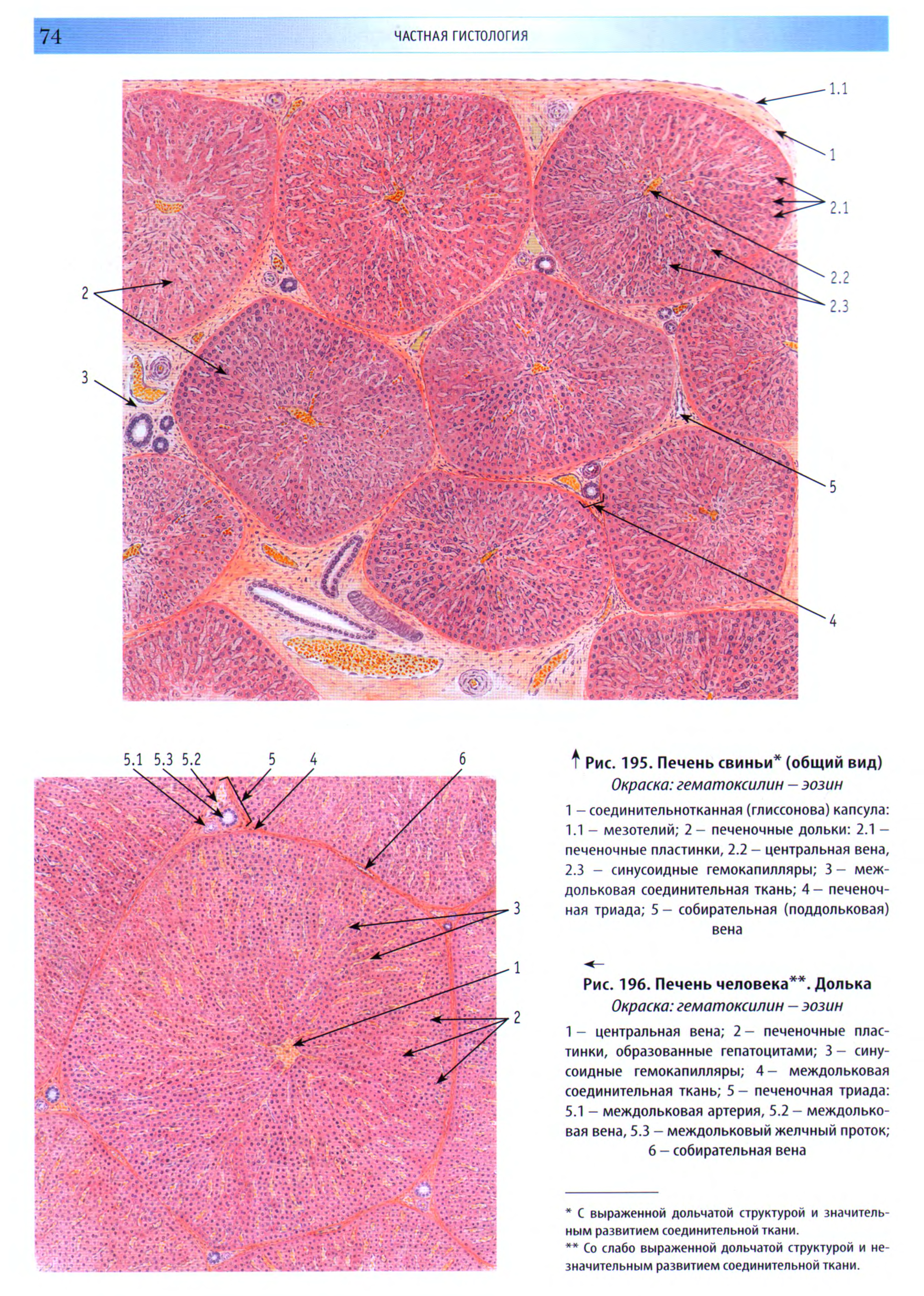 Печень гистология. Строение дольки печени гистология. Печень свиньи гистология препарат. Печень свиньи микропрепарат гистология. Печень гистология препарат.