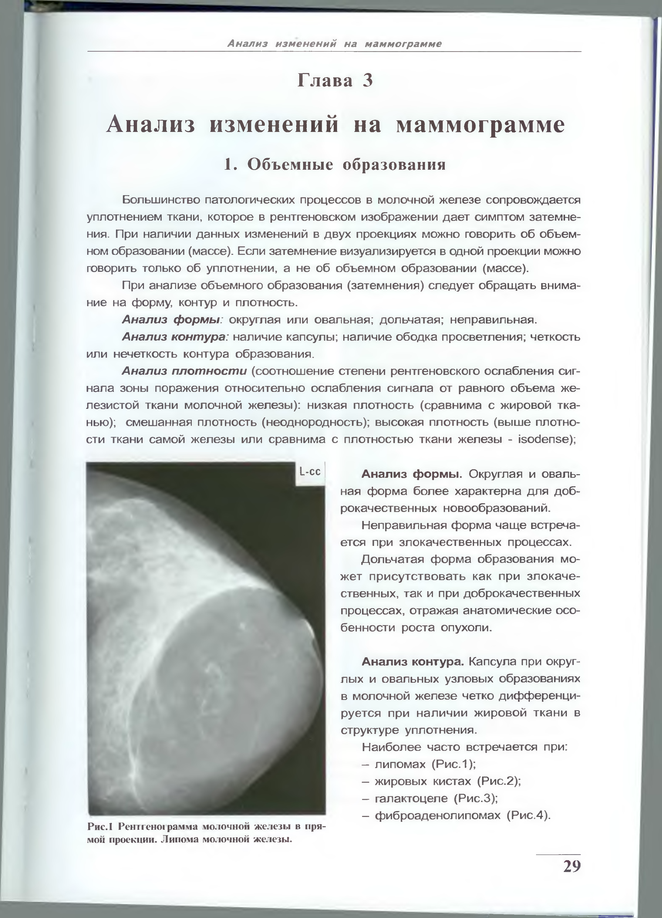 Анатомия молочных желез маммограмма